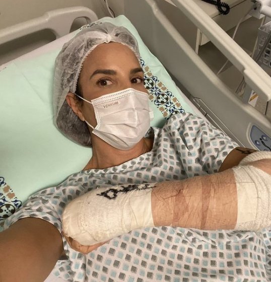 Ivete Sangalo tranquiliza os fãs após a cirurgia: 